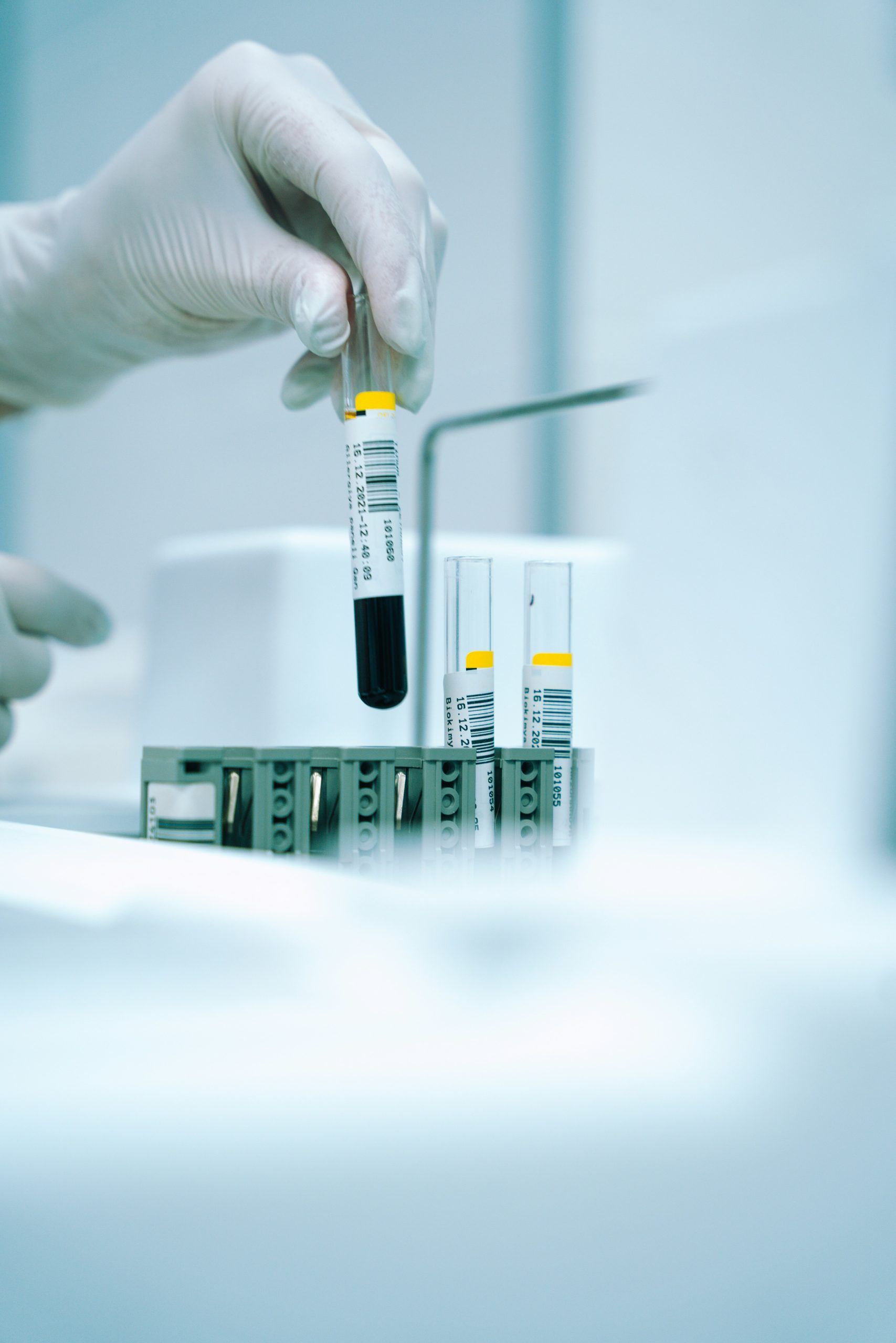 Manos enguantadas manipulando un tubo de muestra para análisis clínicos